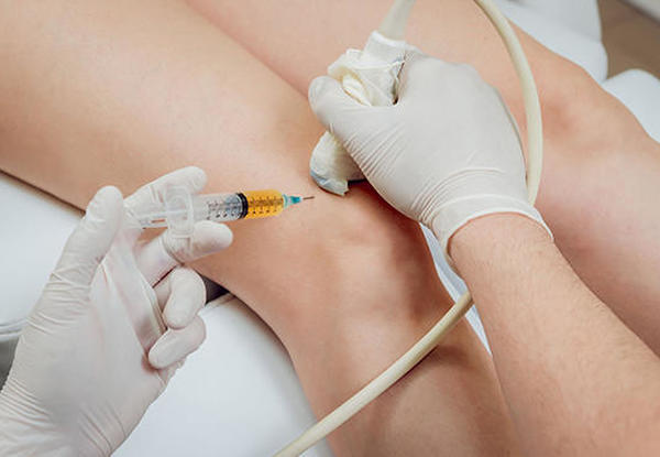 PRP-injeksjon ved kneartrose  – virker det?