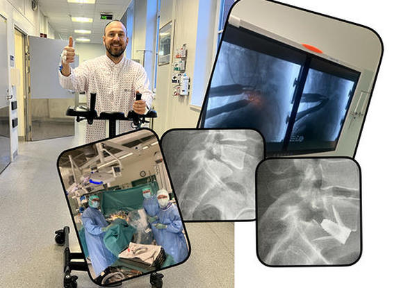 Redaktørens reise  – spondylolisteseoperasjon
